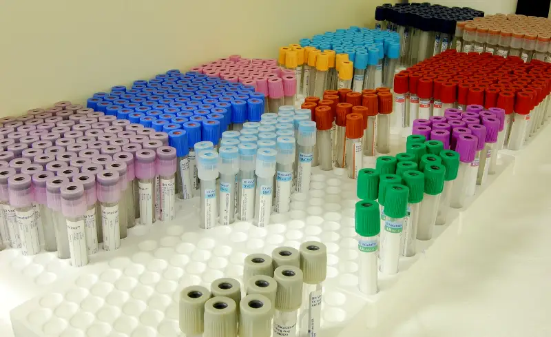 Racks of blood collection tubes sorted by closure color: lavender, blue, pink, light blue, gold, orange, red, green and gray